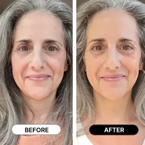 South Beach Collagen Filler Serum